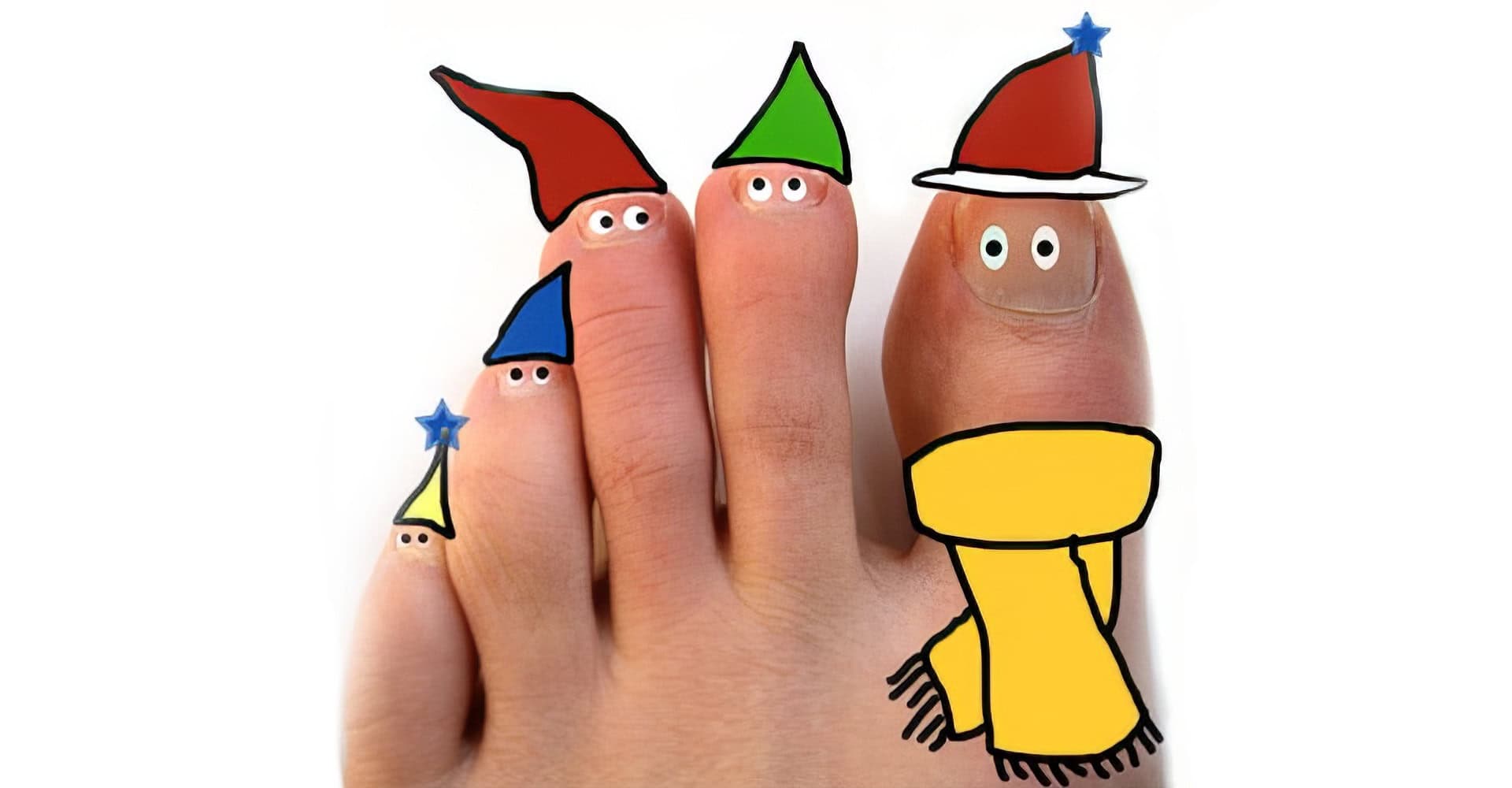 Winterzehen – ein typisch niederländisches Leiden?